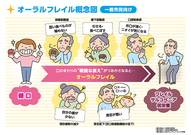 オーラルフレイルの概念図